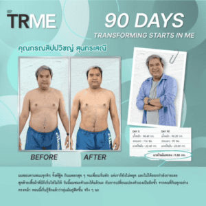 TR90 Nuskin