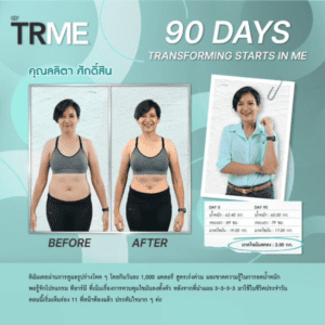TR90 Nuskin