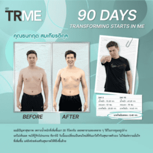 TR90 Nuskin