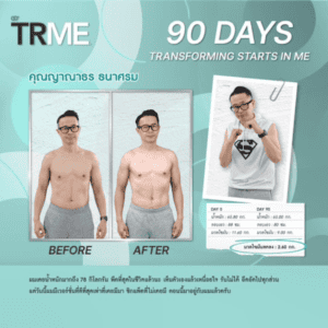TR90 Nuskin