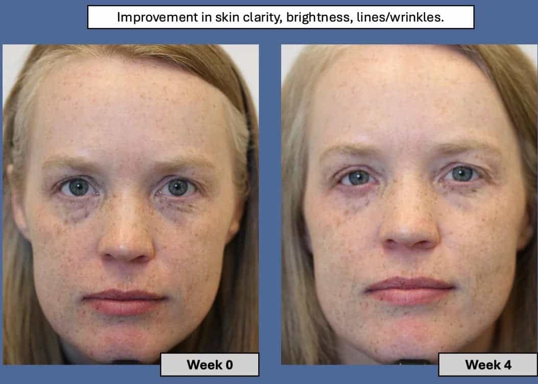 ageLOC TruFace Peptide Retinol Complex