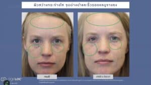เรตินอล Nu Skin ageLOC Tru Face Peptide Retinol Complex
